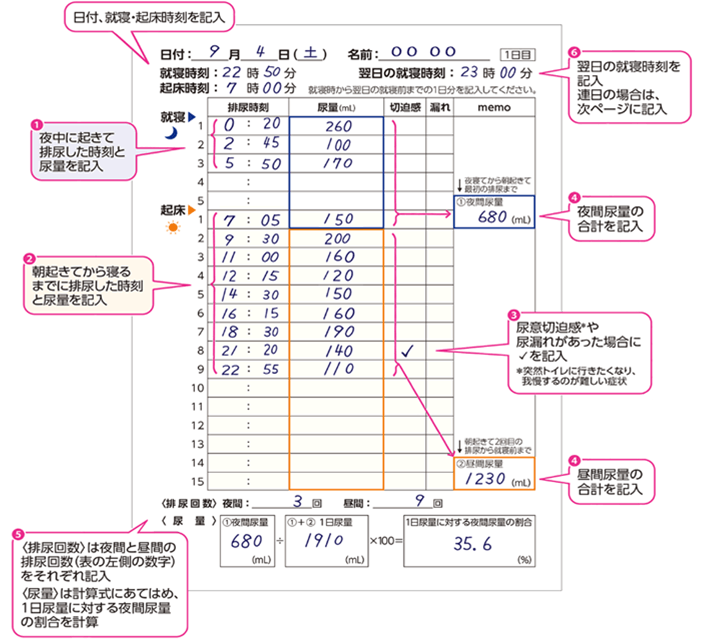 排尿日誌でチェックするイメージ